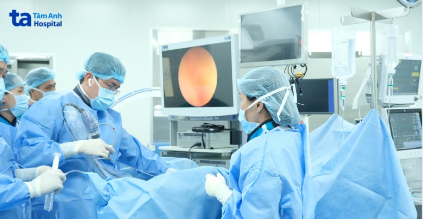 điều trị sỏi niệu quản 1 3 dưới