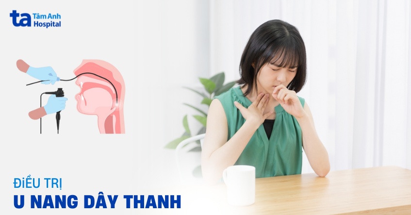 Điều trị u nang dây thanh quản và lưu ý khi chữa bệnh