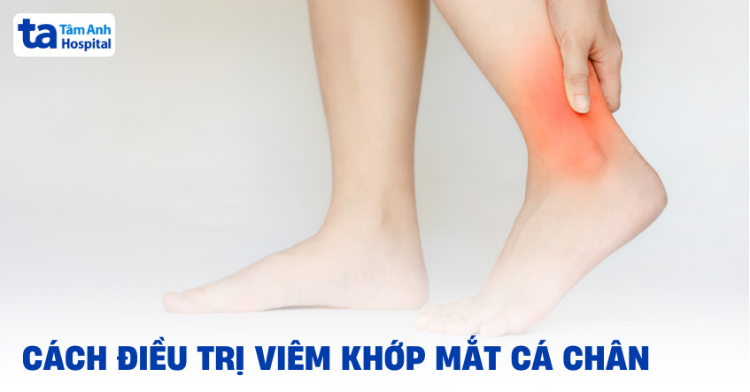 Điều trị viêm khớp mắt cá chân