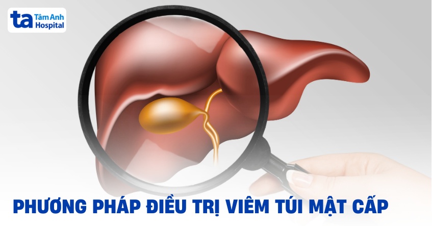 6 phương pháp điều trị viêm túi mật cấp tính hiệu quả, an toàn