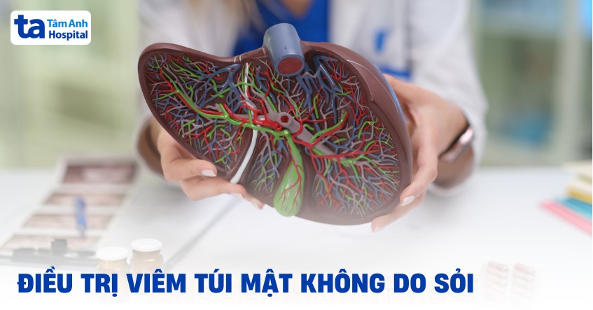 7 phương pháp điều trị viêm túi mật không do sỏi hiệu quả
