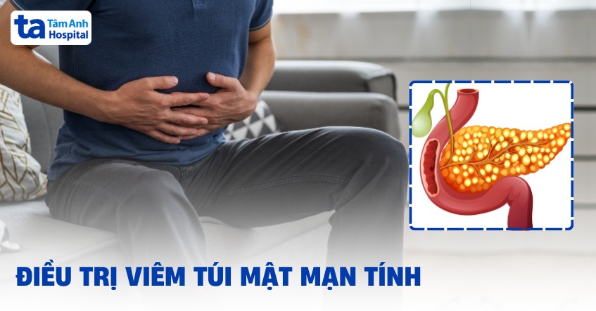 5 phương pháp điều trị viêm túi mật mạn và phòng ngừa tái phát