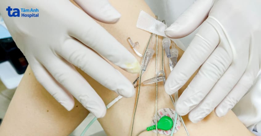 đo áp lực bàng quang tại bệnh viện tâm anh