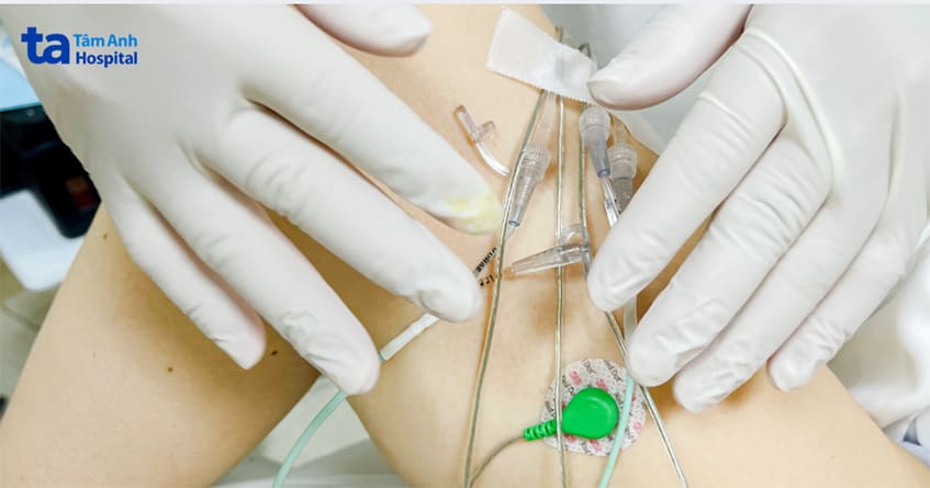 đo bằng mấy đo động niệu học chi phí cao hơn