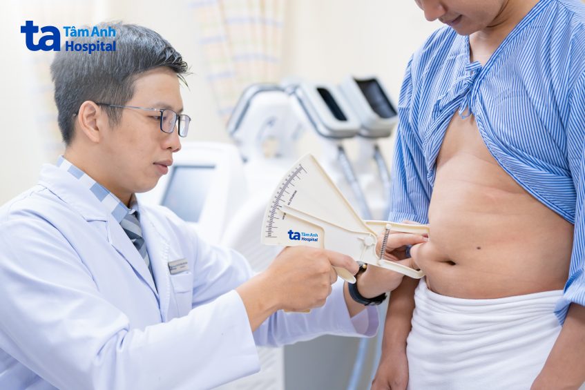 đo độ dày mỡ bụng trước điều trị