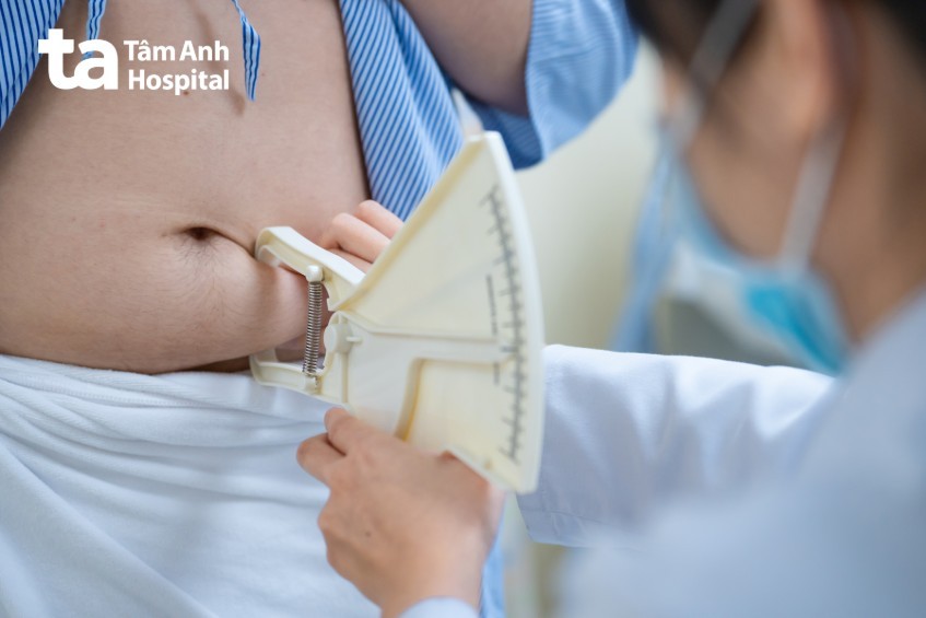 đông hủy mỡ giảm mỡ bụng dưới