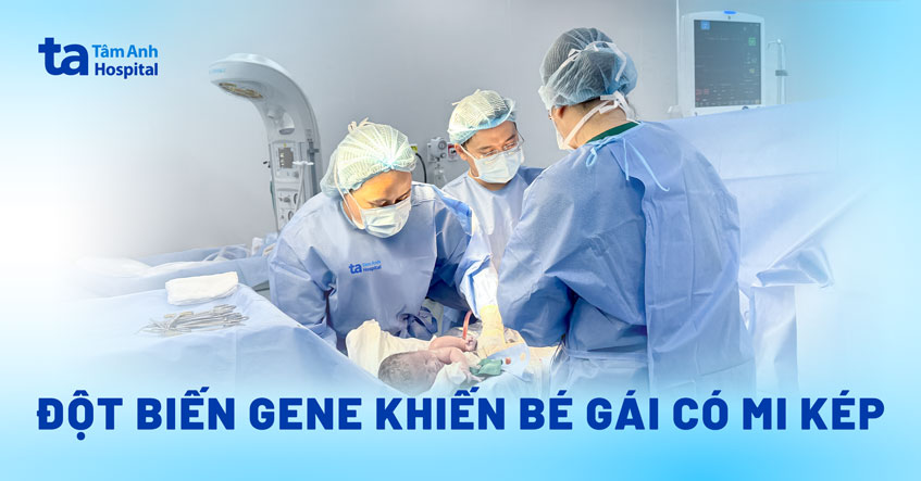 đột biến gen có mi kép
