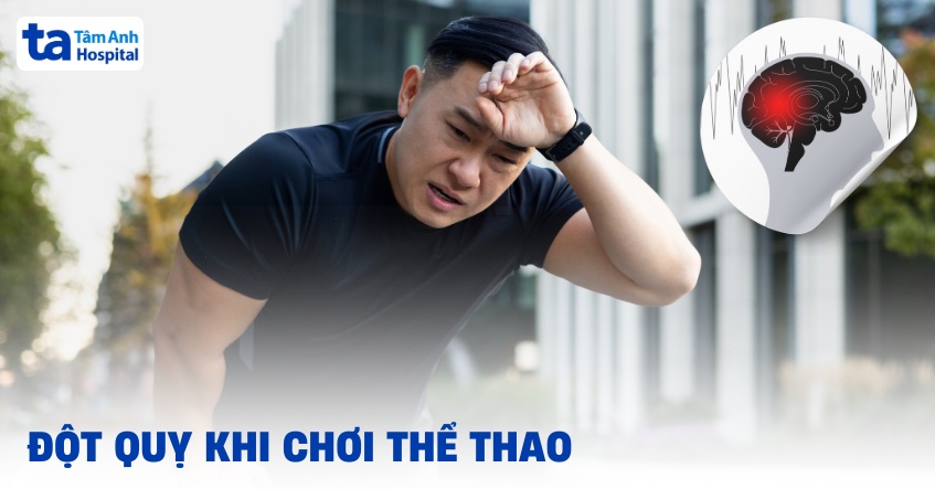 Đột quỵ khi chơi thể thao: Nguyên nhân, dấu hiệu, cách phòng tránh