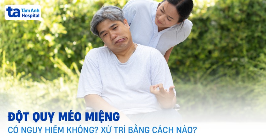 Triệu chứng đột quỵ méo miệng cần lưu ý và cách xử trí đúng