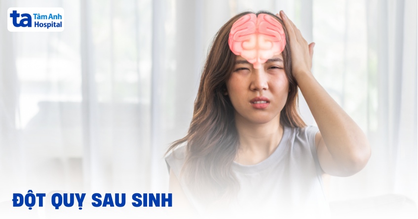 Đột quỵ sau sinh: Nguyên nhân, dấu hiệu, điều trị và phòng ngừa
