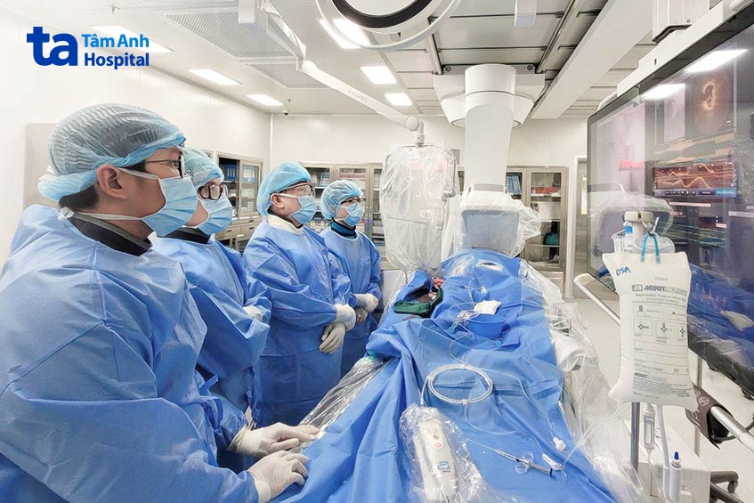 Ê kíp chụp OCT sau can thiệp để kiểm tra xem có bóc tách nội mạc hai đầu stent, đảm bảo stent nở tốt, áp sát thành mạch