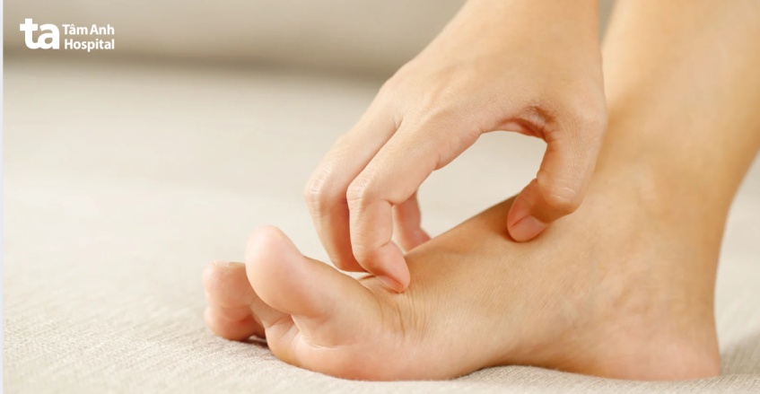 gãi quá nhiều sẽ khiến da bị tổn thương