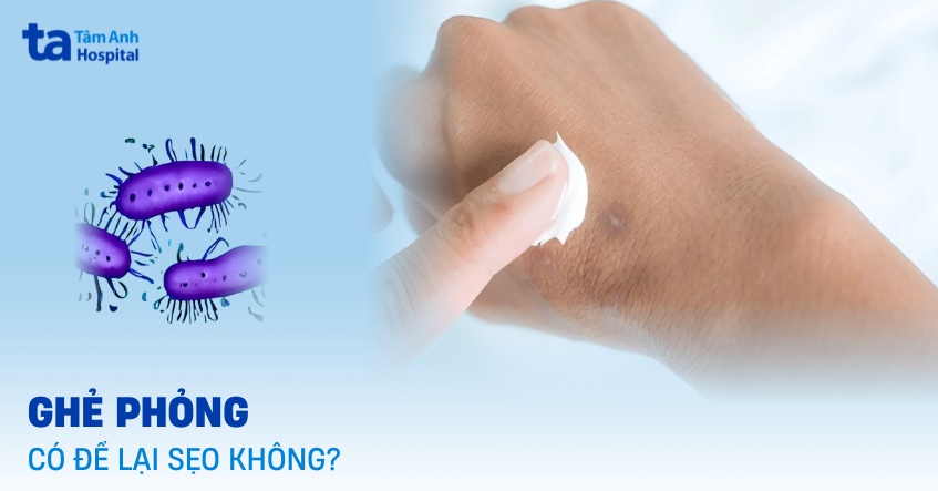 Ghẻ phỏng có để lại sẹo không? Yếu tố nào ảnh hưởng?