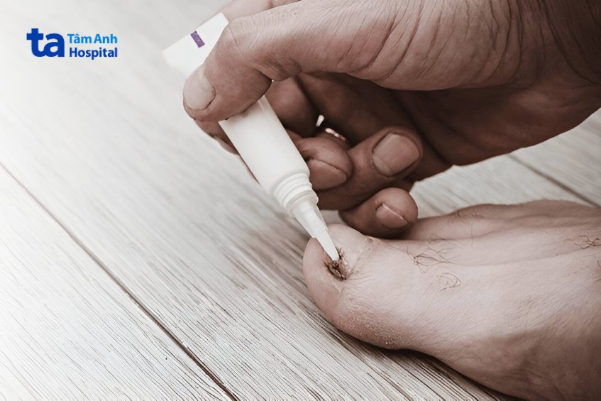 giải pháp của bác sĩ