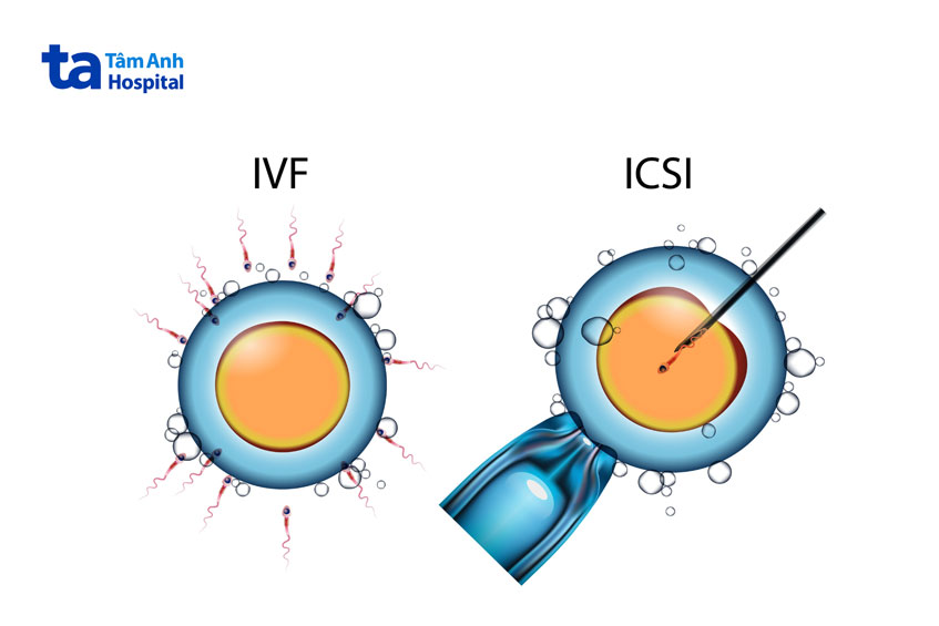 giải pháp cứu cánh cho quý ông