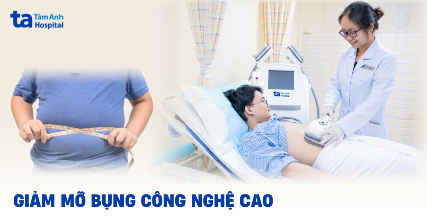 Phương pháp giảm mỡ bụng công nghệ cao không xâm lấn an toàn