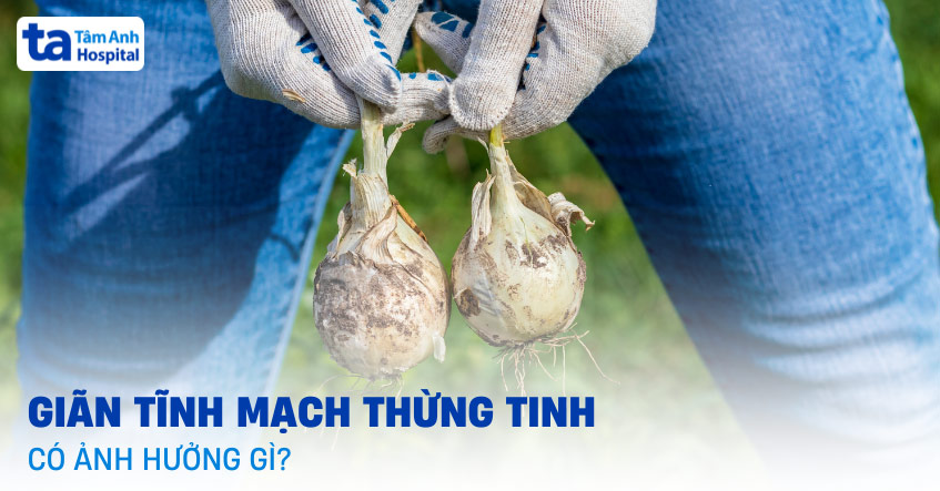 Giãn tĩnh mạch thừng tinh có ảnh hưởng gì đến đời sống nam giới?