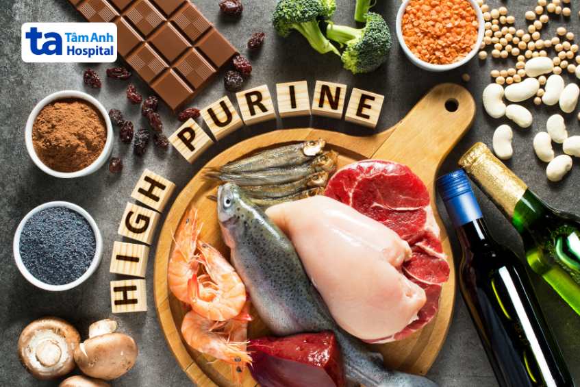 hạn chế purin giảm nguy cơ gút