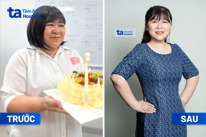 Kết quả sau liệu trình giảm cân an toàn tại BVĐK Tâm Anh