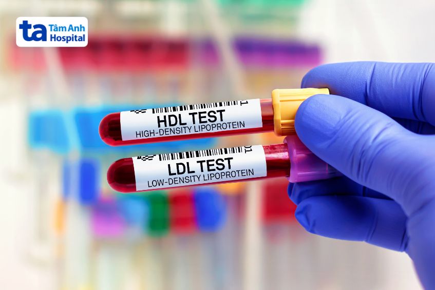 HDL-C và LDL-C là hai loại cholesterol phổ biến trong cơ thể.