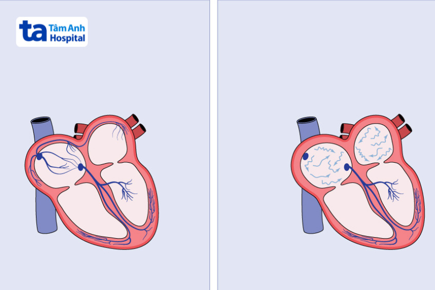 Hệ dẫn truyền tim tạo và điều phối nhịp tim giúp duy trì hoạt động bơm máu hiệu quả
