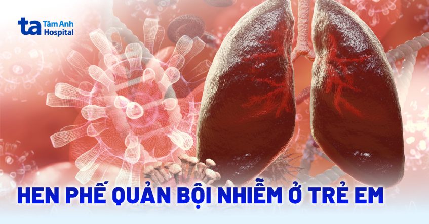 Hen phế quản bội nhiễm ở trẻ em: Nguyên nhân và cách chẩn đoán