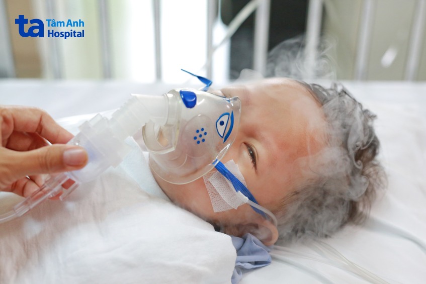 hen phế quản ở trẻ có thể được kiểm soát tốt