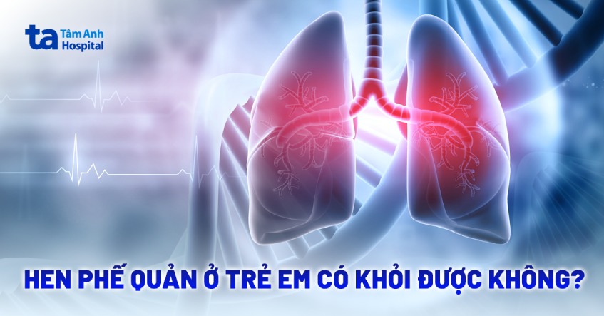 Hen phế quản ở trẻ em có khỏi được không? Có dứt điểm hoàn toàn?