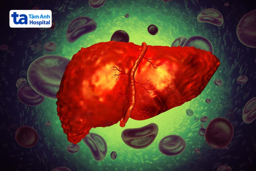 hình ảnh bị bệnh bạch hầu có thể gây tổn thương gan
