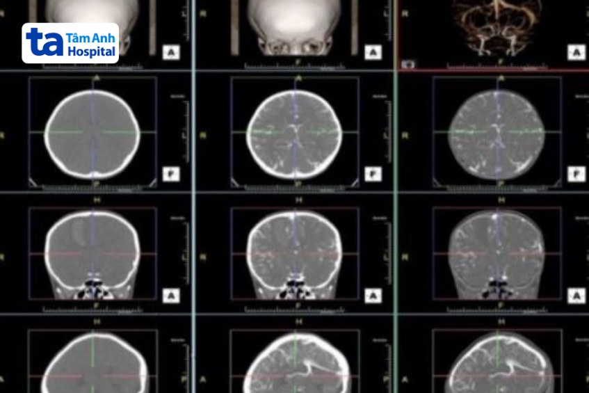 hình ảnh chụp ct 16 dãy