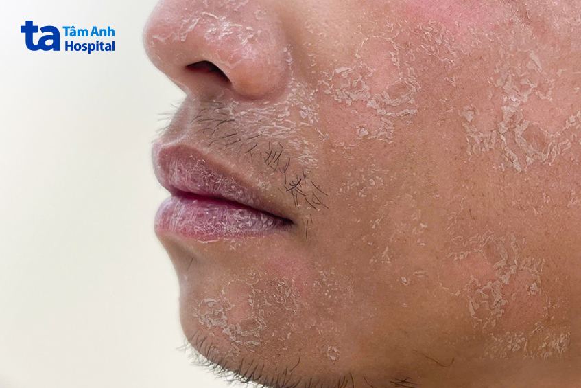 hình ảnh người bệnh điều trị