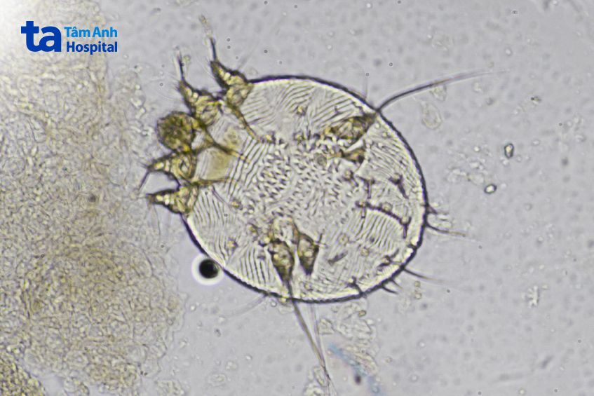 hình ảnh nhận biết con ve ghẻ