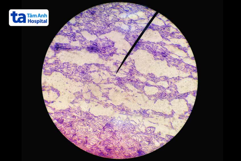 hình ảnh vi khuẩn bạch hầu