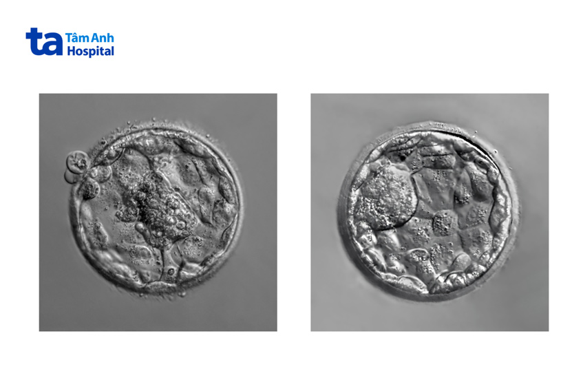 Hình thái và số lượng tế bào phôi ngày 6 tương đương phôi nang ngày 5