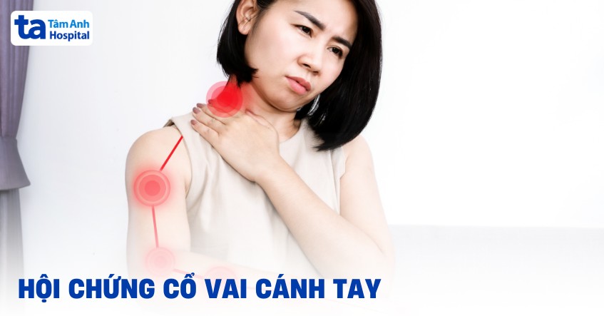 hội chứng cổ vai cánh tay