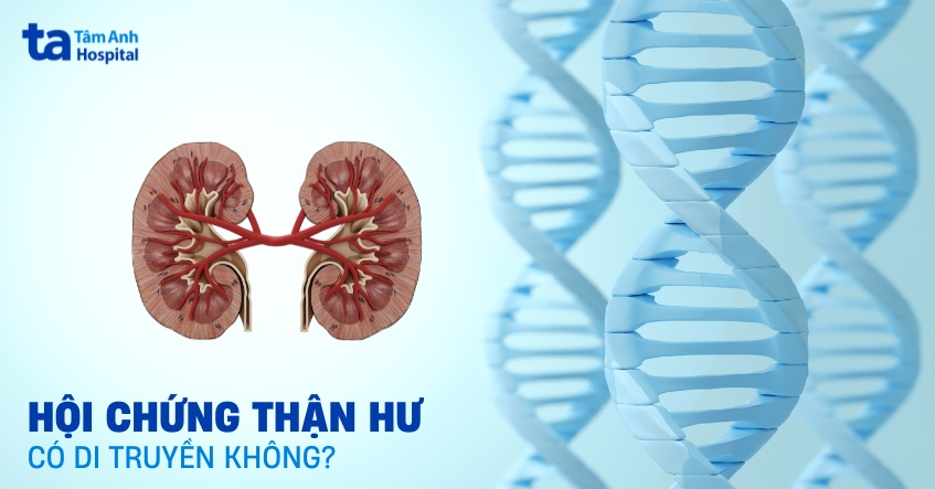 Hội chứng thận hư có di truyền không? Biện pháp phòng ngừa