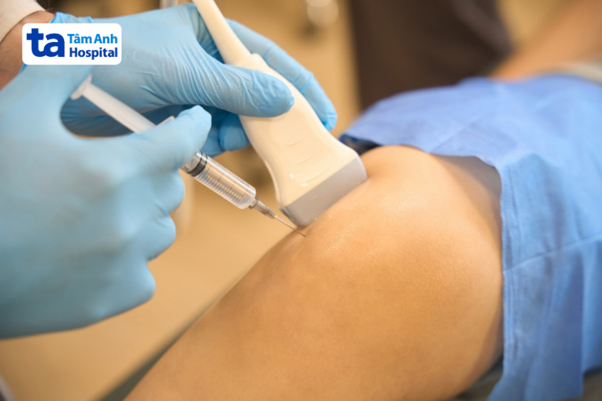 Hút dịch khớp thường được sử dụng trong điều trị