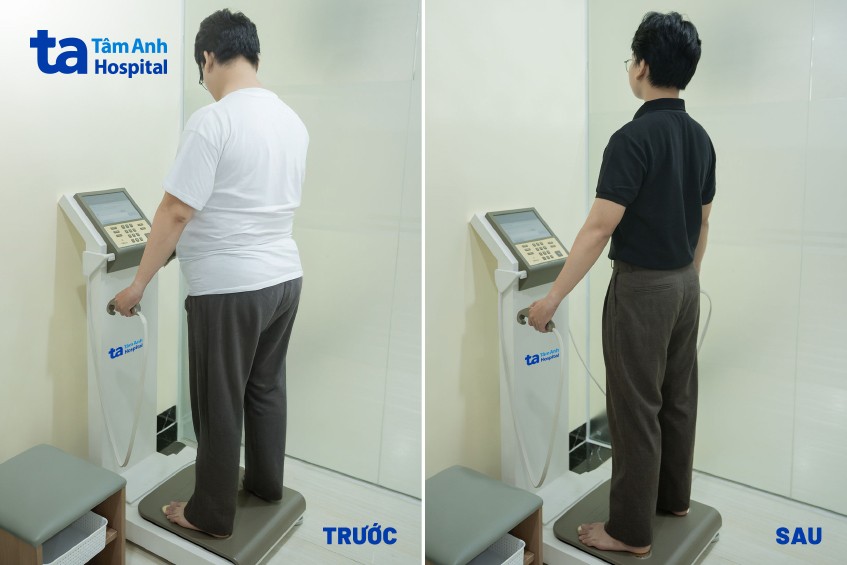 khách hàng trước và sau điều trị tại tâm anh