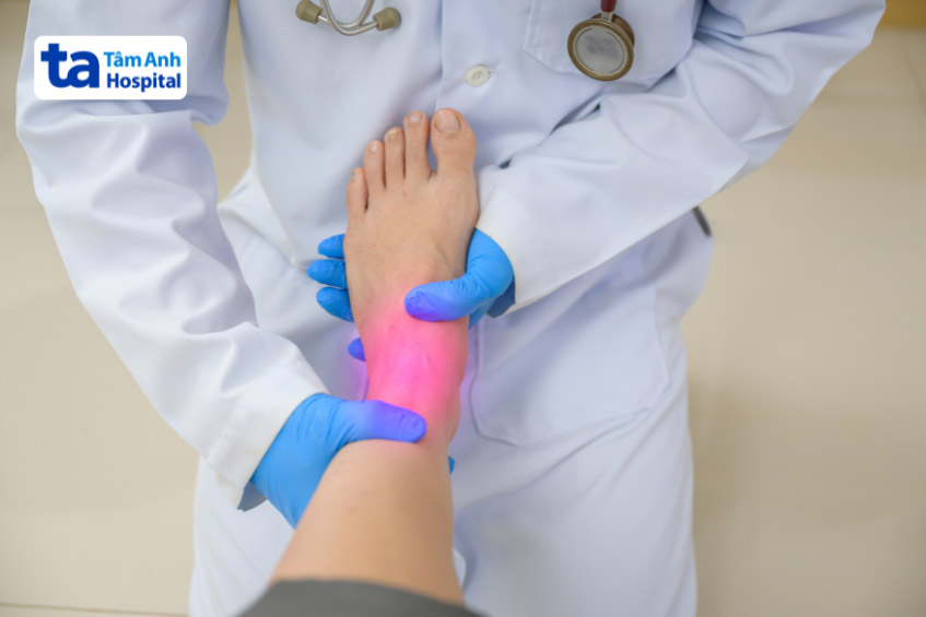 khám lâm sàng cho người bị phình động mạch ngoại biên