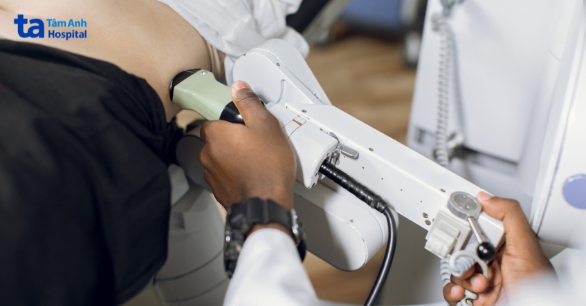 khi nào sỏi niệu quản có thể tán