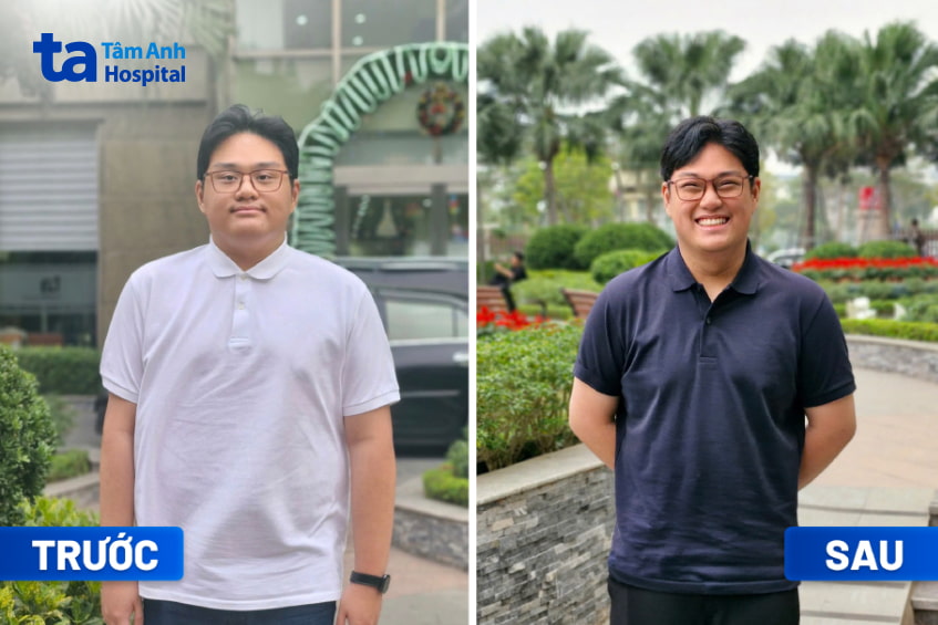 Anh Hà giảm cân thành công khi điều trị tại BVĐK Tâm Anh