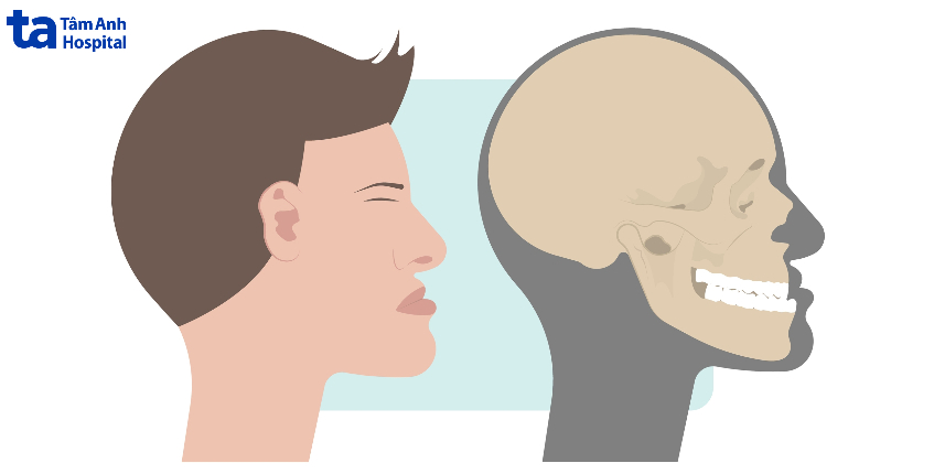 Sai khớp cắn loại 3 là gì?