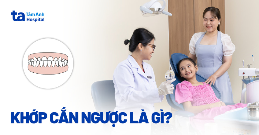 Khớp cắn ngược là gì? Nguyên nhân, dấu hiệu và cách điều trị