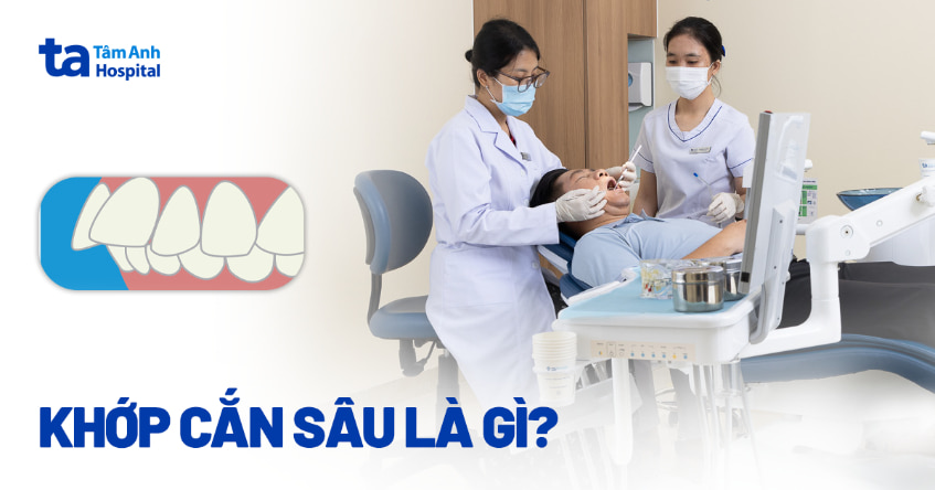 Khớp cắn sâu là gì? Nguyên nhân, cách nhận biết và điều trị