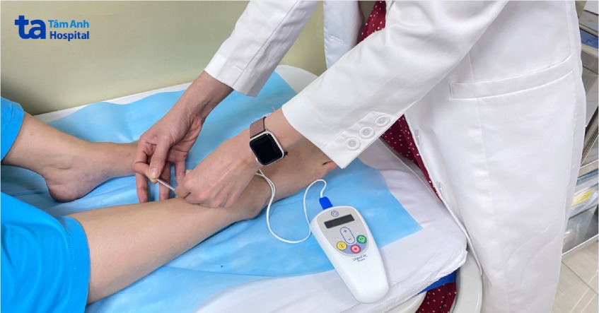 kích thích dây thần kinh chày là gì