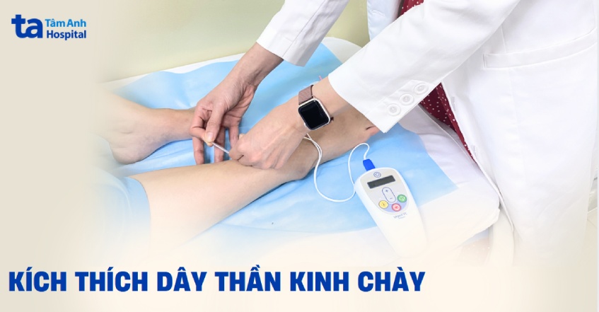 kích thích thần kinh chày