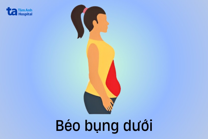 kiểu béo bụng dưới