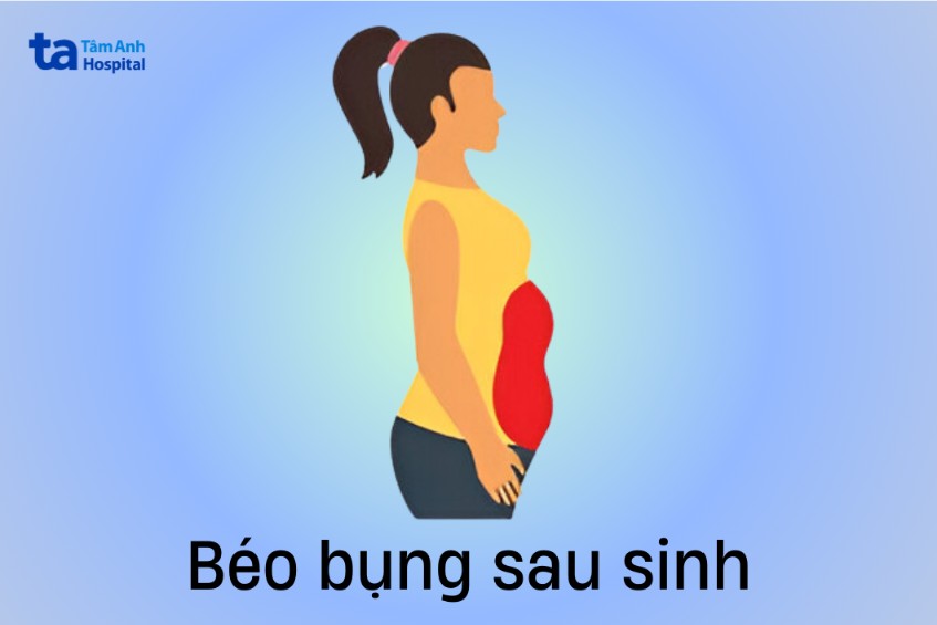 kiểu béo bụng sau sinh