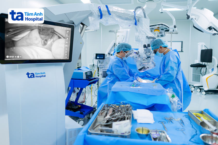 Kỹ thuật vi phẫu micro-TESE cao cấp được thực hiện trong phẫu trường hiện đại tại BVĐK Tâm Anh TP.HCM