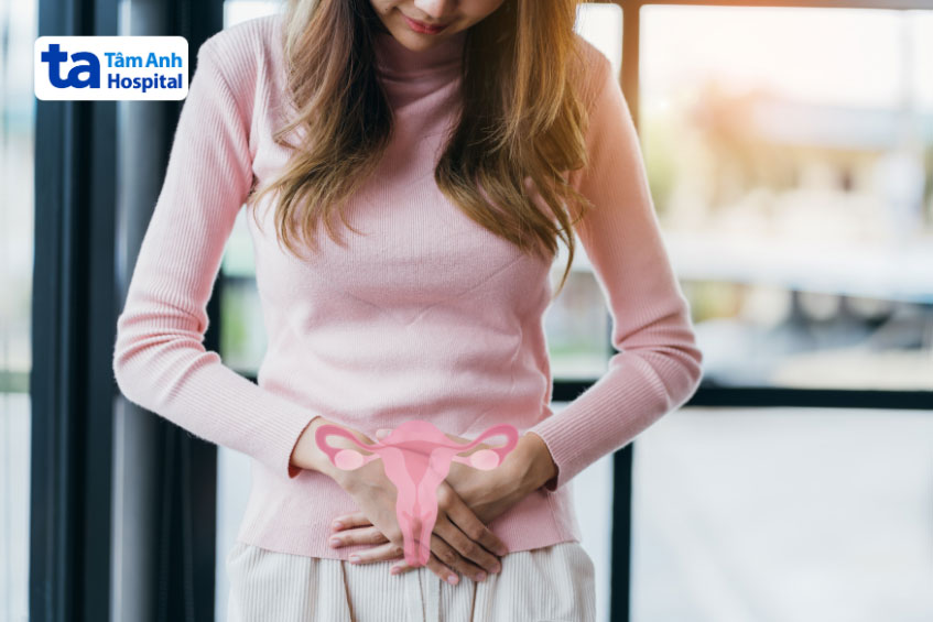 liên quan đến hội chứng pcos